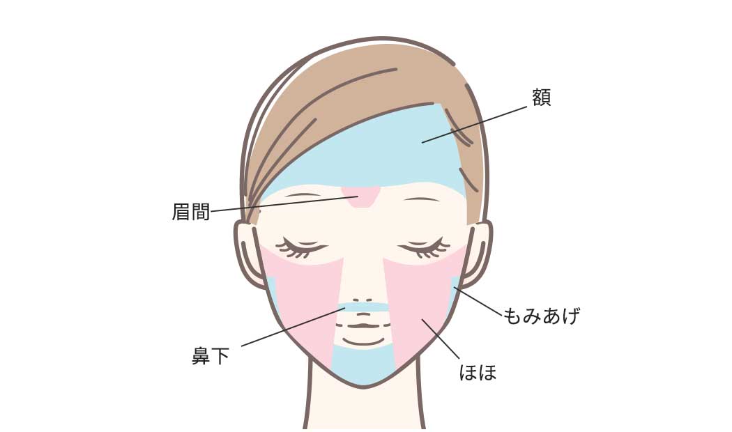 額・眉間・もみあげ・ほほ・鼻下の照射部位の図